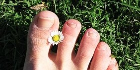 Gljiva noktiju na nogama