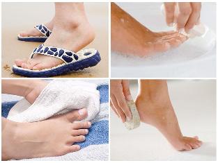 gljiva kože nogu prevencija